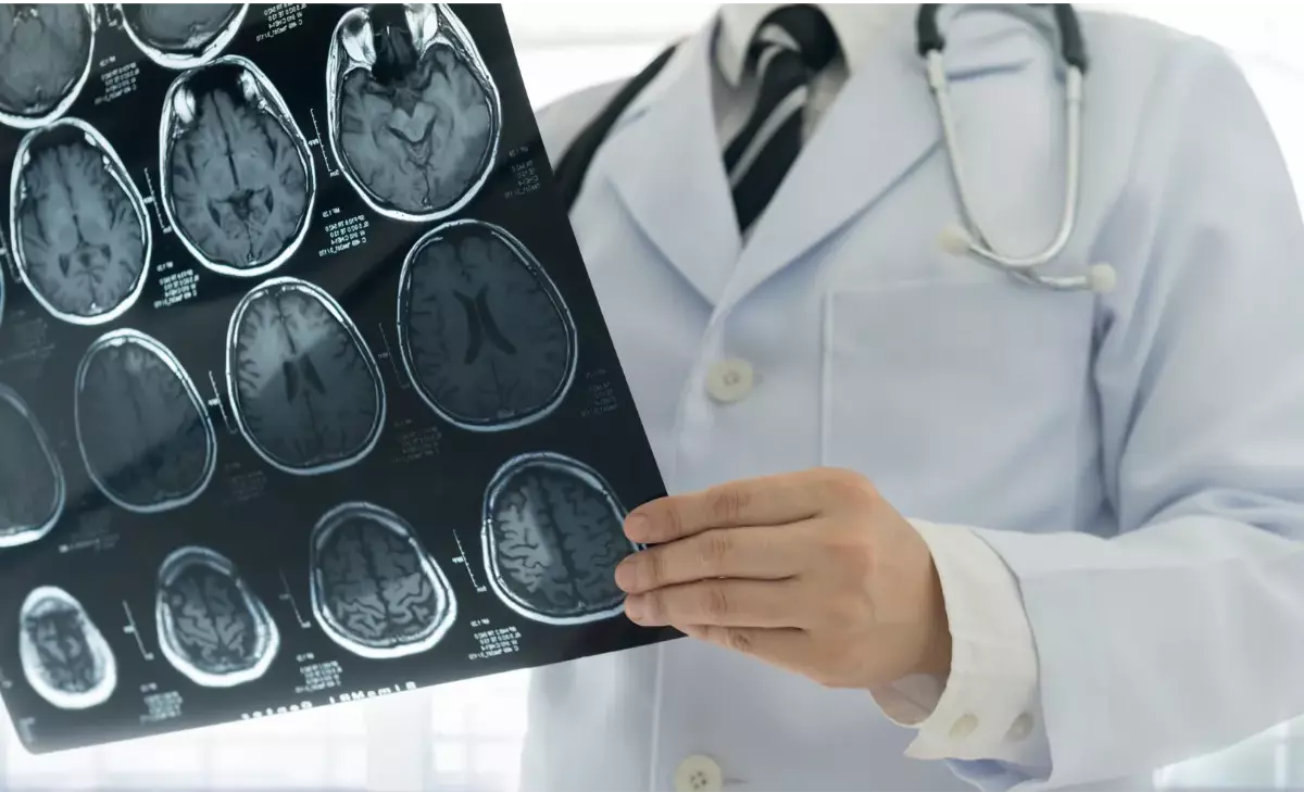 O que faz um neurologista? Esse é o médico responsável por tratar das doenças e condições que acometem o sistema nervoso, entre eles a enxaqueca, epilepsia, mal de Parkinson e outros. Consulte um neurologista caso tenha dores de cabeça persistentes.
